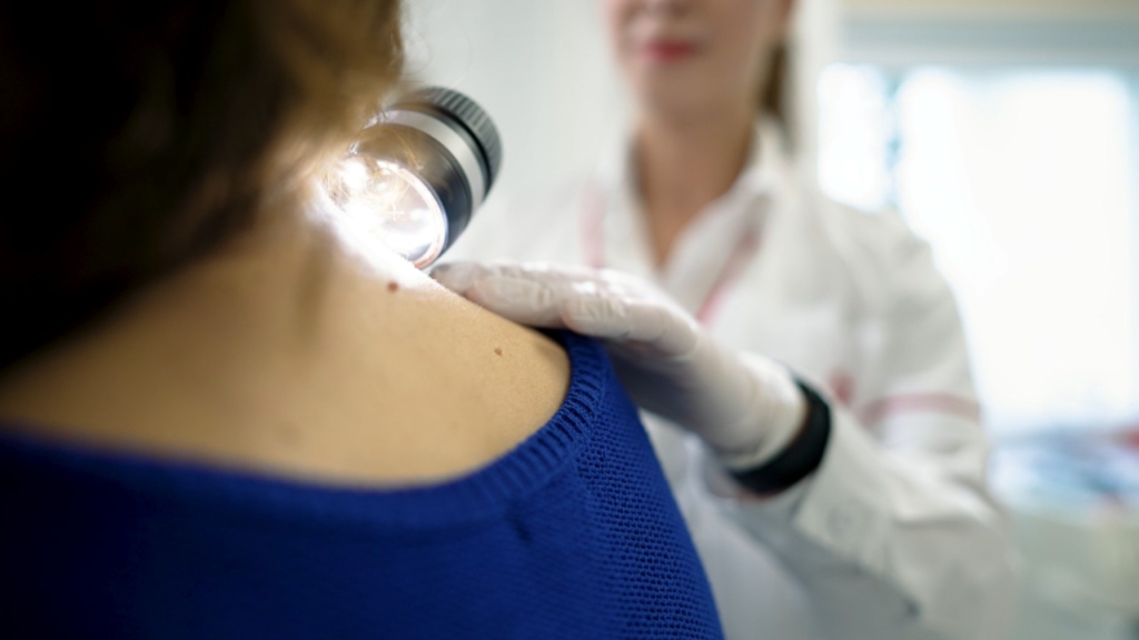 Primul centru multidisciplinar integrat pentru tratarea melanomului deschis în cadrul spitalului Euroclinic. Pacienții beneficiază acum de un parcurs complet de îngrijire: diagnostic, tratament și monitorizare, toate într-un singur loc. (P)