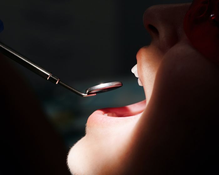 Arginina reduce riscul de carii dentare